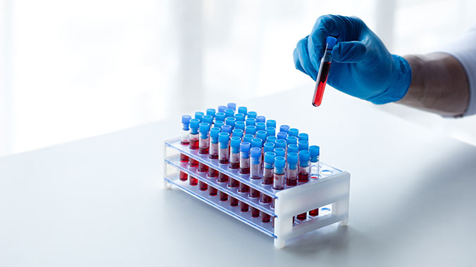 serology