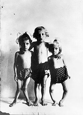 Photograph of three children with rickets (undated, Wellcome Collection) 